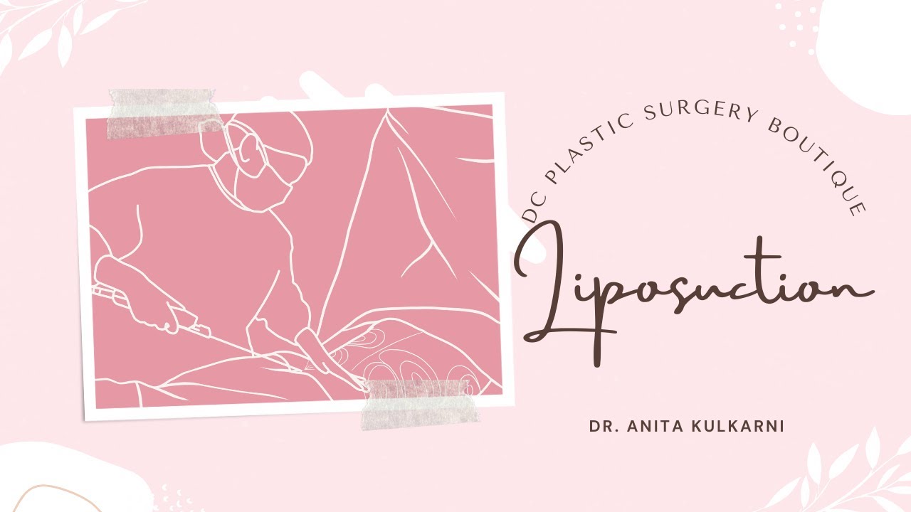 Liposuction at DC Plastic Surgery Boutique