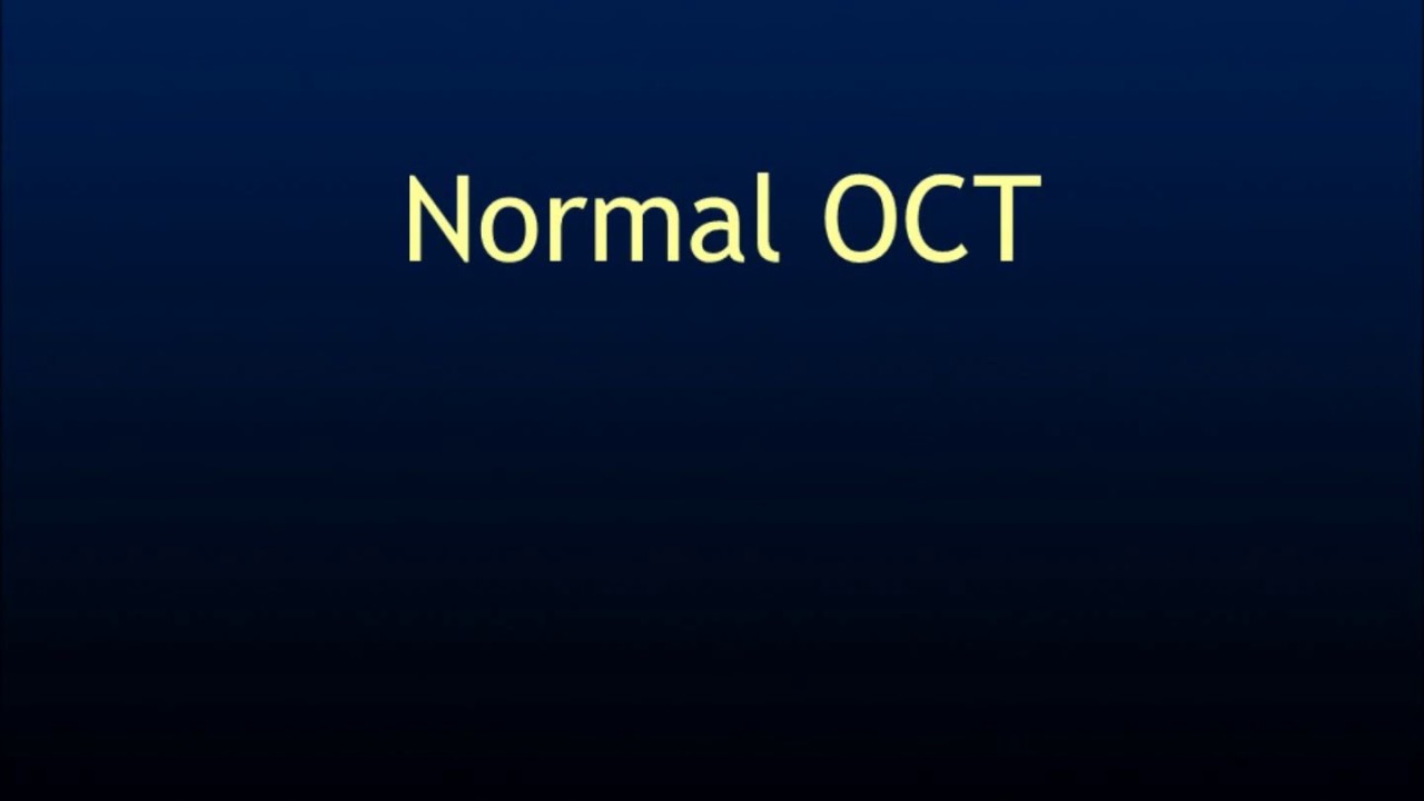 Normal OCT