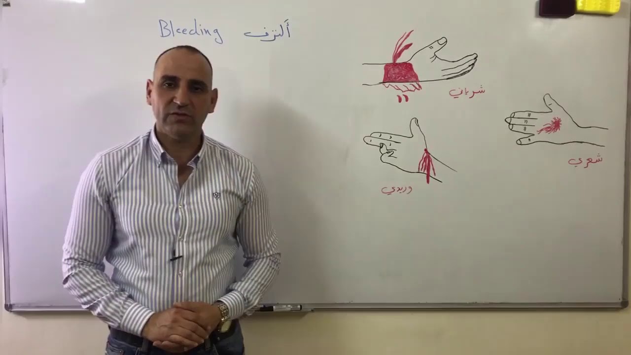 كيفية ايقاف النزف  How to stop bleeding