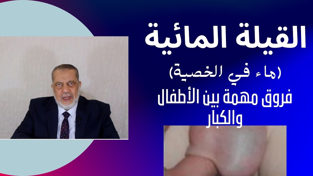 قيلة مائية (ماء في الخصية) في الأطفال وفي الكبار/ما سبب تكونها/هل تؤثر على الإنجاب/التشخيص/العلاج