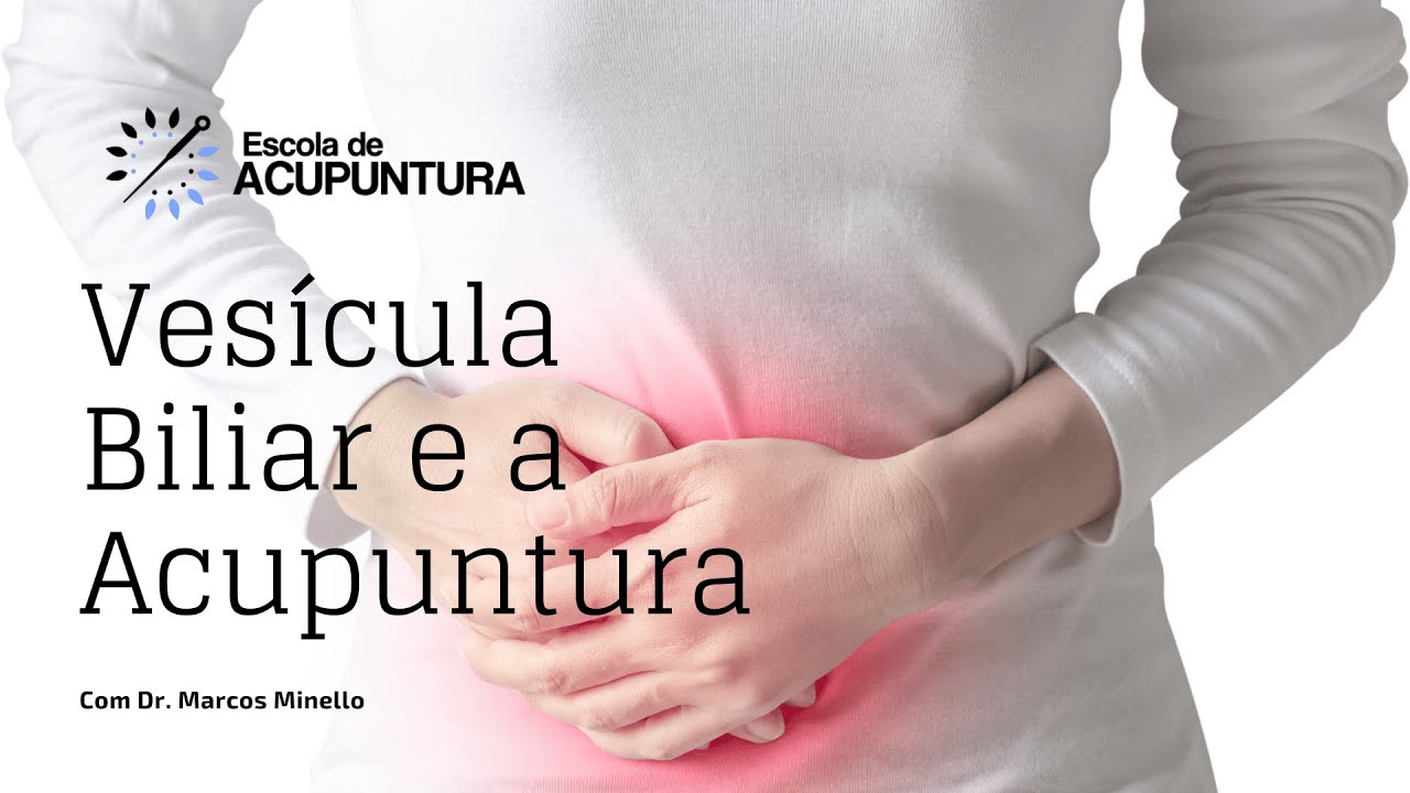 Acupuntura: Alternativa eficaz no tratamento de pedra na vesícula biliar