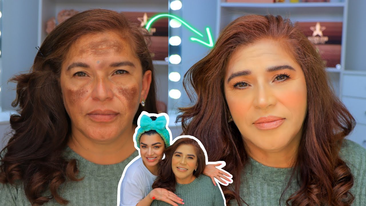 MAQUILLANDO LA PIEL CON MELASMA DE MI MAMÁ. Truco para camuflar manchas con maquillaje.