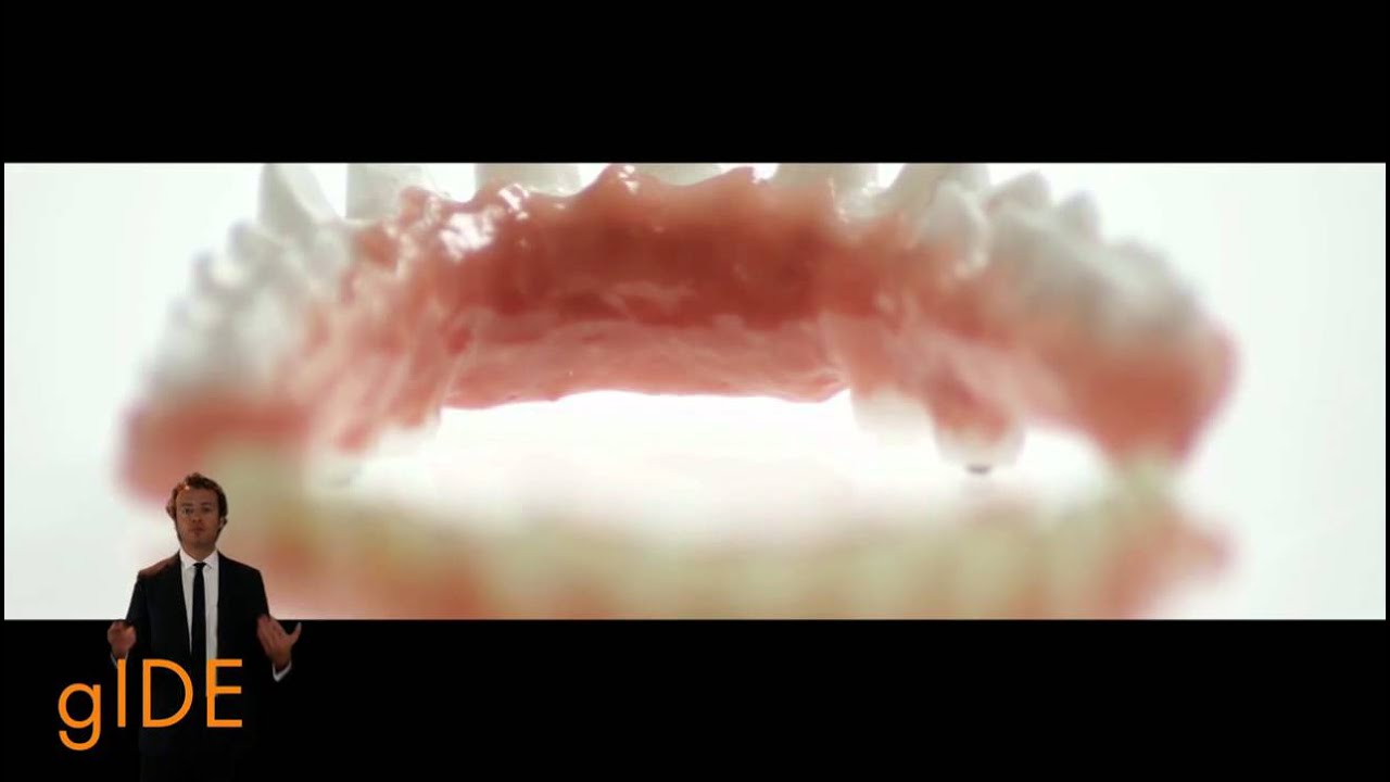 248-00 A Novel Approach to Implant Screw-Retained Restorations PREVIEW