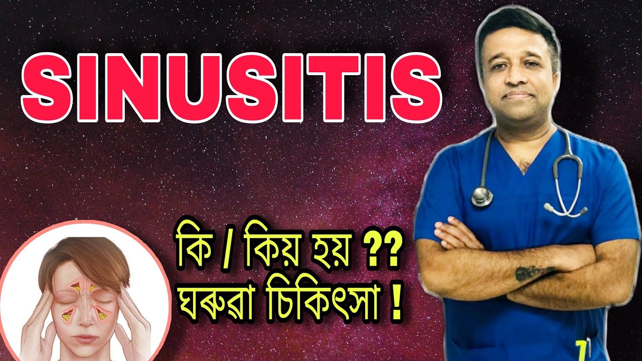 প্ৰায়ভাগ মানুহে জীৱনৰ কোনোবা নহয় কোনোবা সময়ত ভুগা বেমাৰ SINUSITIS !! #sinusitis #devottom  #axom