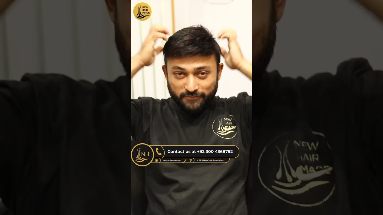THE POWER OF NATURE: HAIR TRANSFORMATION #hairpatch #hairreplacement #haircut #ytshorts