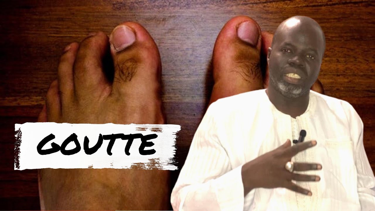 #1 - La goutte: Sympt&ocirc;mes et Causes - Pr Ousmane Ndiaye - SAMA XALAAT TV
