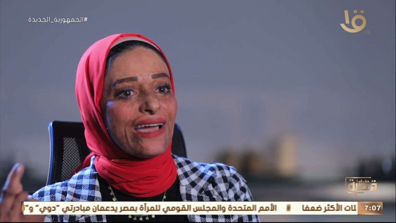 قصة حقيقية| بطلة اليوم منال حسني التي تغلبت على الحروق مع سالي عبد السلام.. الحلقة الكاملة 20-3-2022
