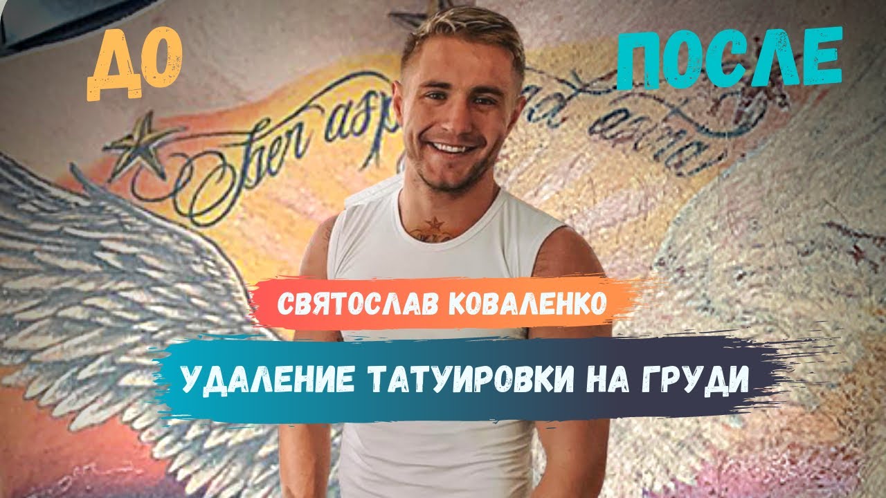 Удаление БОЛЬШОЙ татуировки на груди |Результат ДО&ПОСЛЕ| Святослав Коваленко