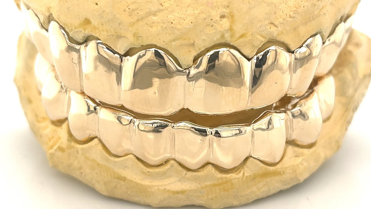 10 top 10 bottom gold grillz by Seattle Gold Grills