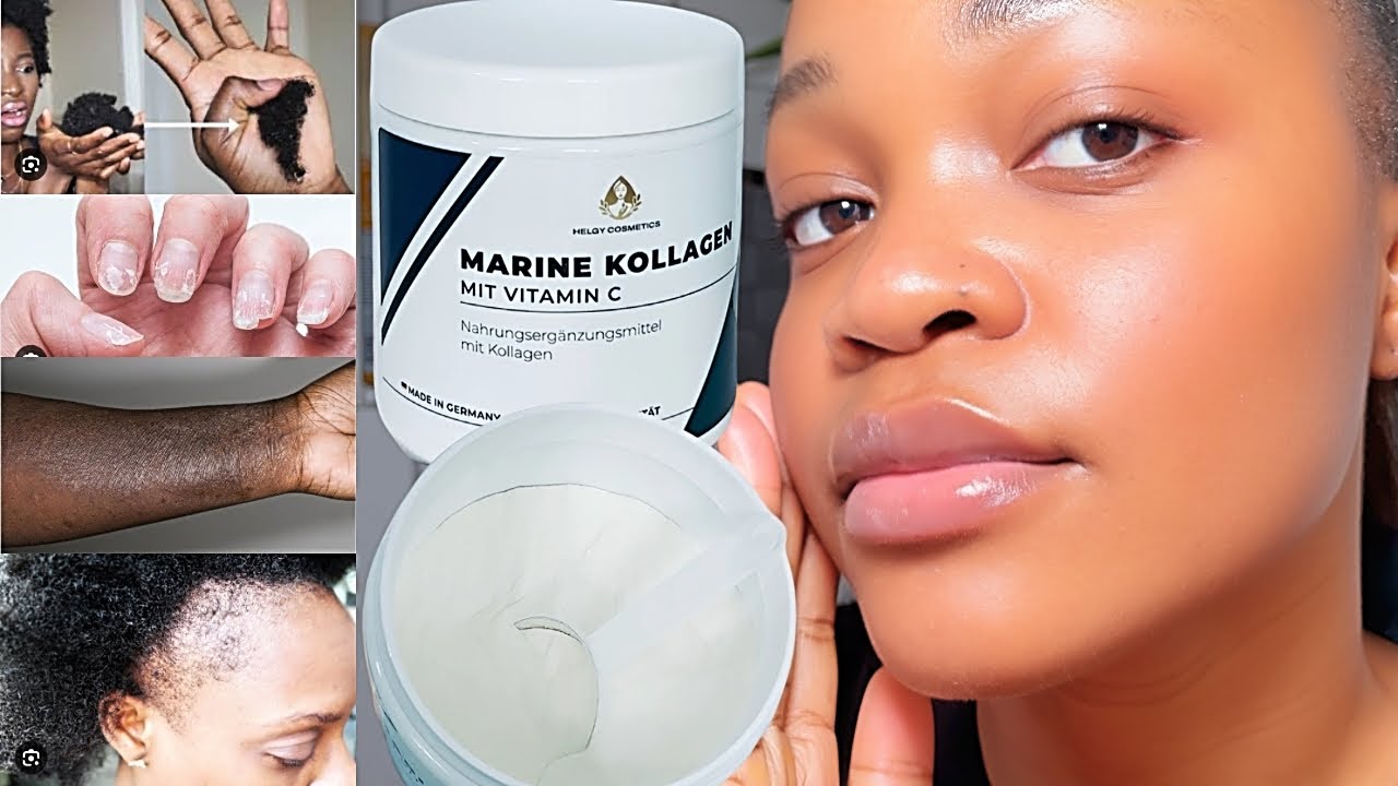 Collagène Marin Hydrolysé + Vitamine C : La Solution Miracle Contre les Imperfections de la Peau