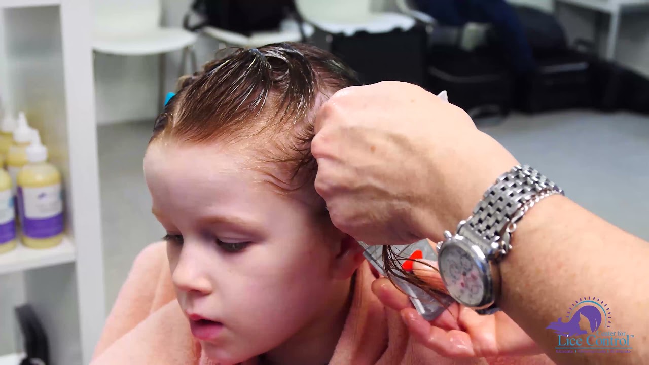 Lice Treatment Comb-Out for Long Hair
