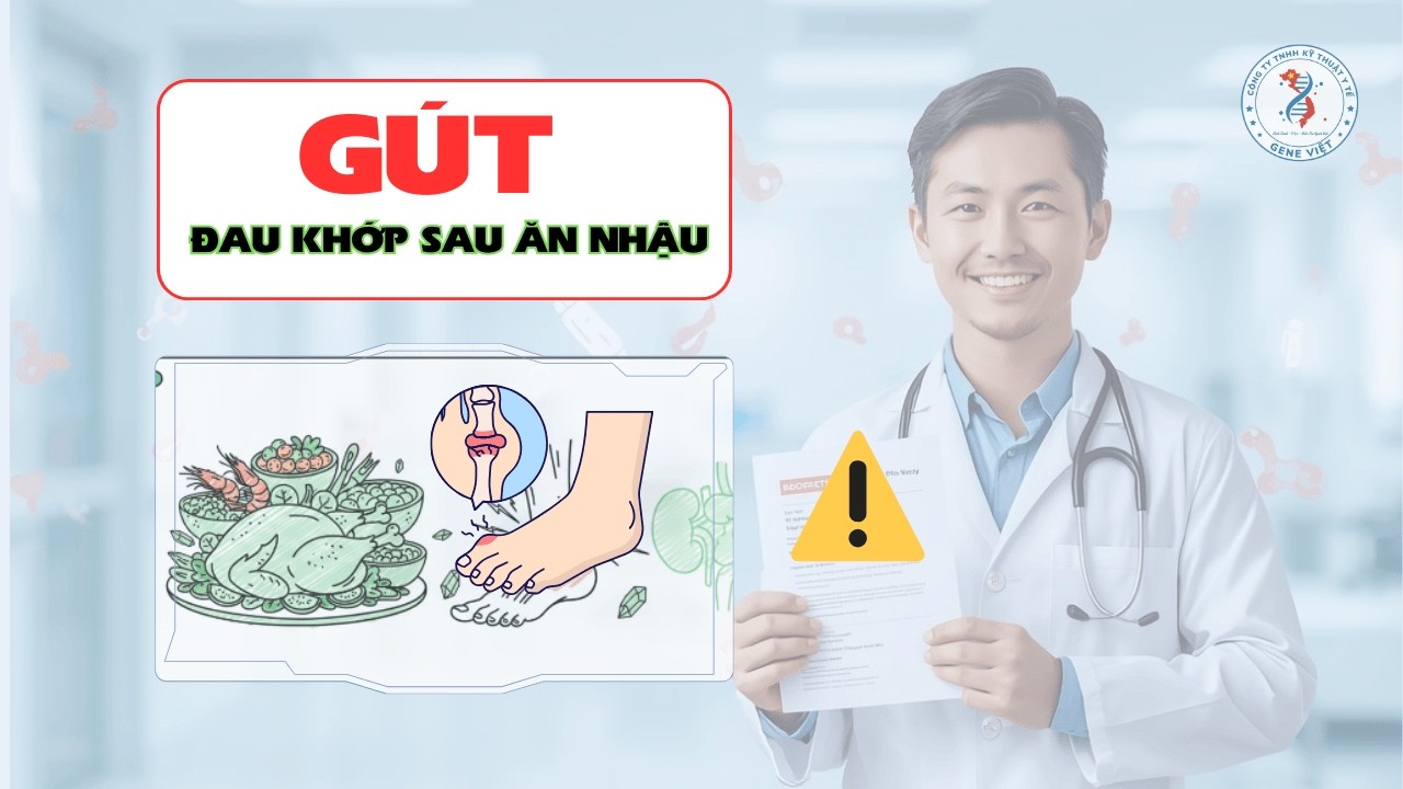 🎯 Gút: Đau Khớp Sau Ăn Nhậu | Vì Sao Uric Tăng Đột Ngột?