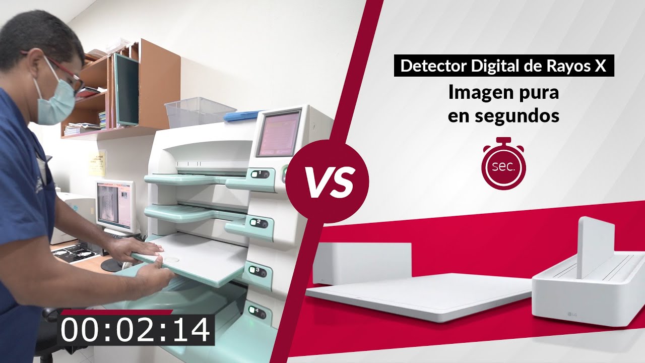 Proceso de imagen entre el CR & DR (Flat Panel).