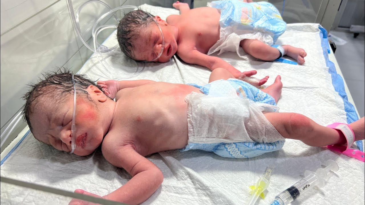 Miracle Moments: Twins Baby Just Born