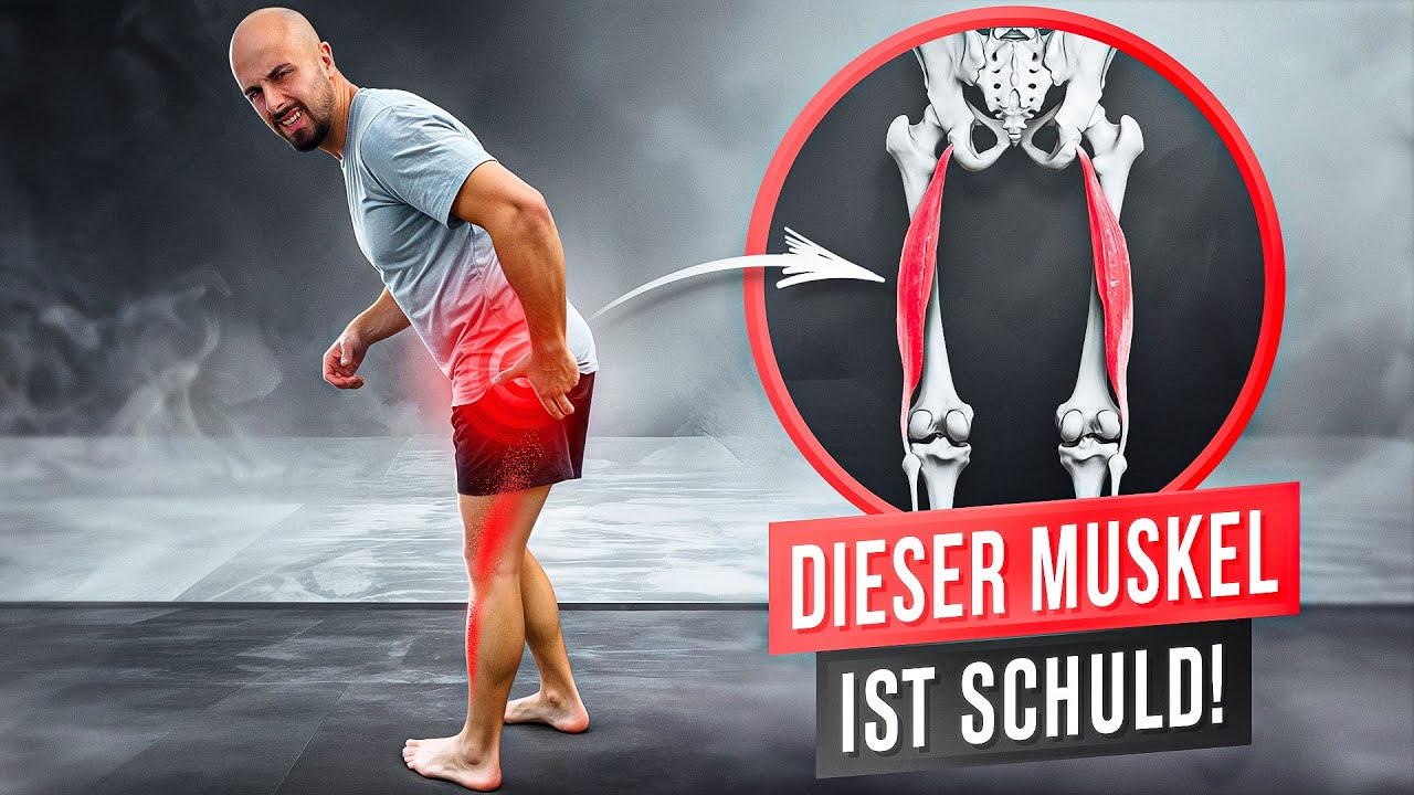 Ischias & Schmerzen Beinrückseite (Es ist NICHT deine Bandscheibe) | Ursache & Lösung