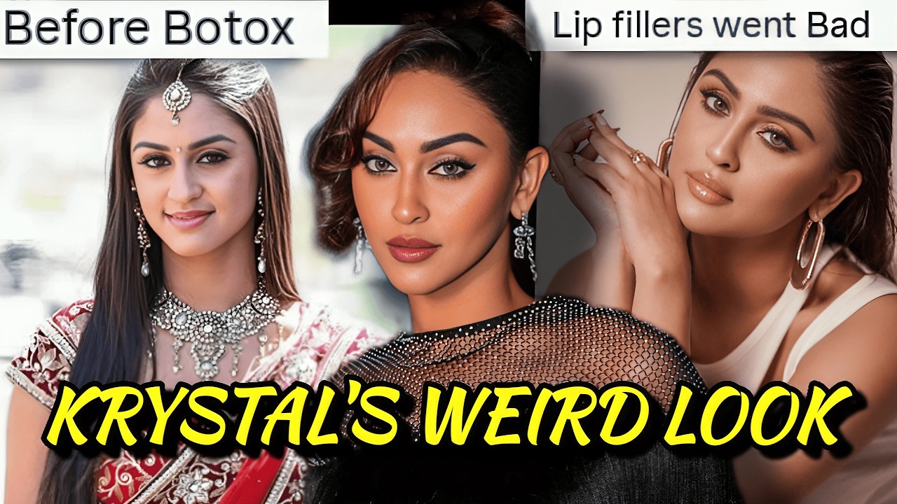 KRYSTAL DSOUZA BAD NOSE JOB & LIP FILLERS: GLORIFYING WEIRD BEAUTY STANDARDS & FAKE CONFIDENCE