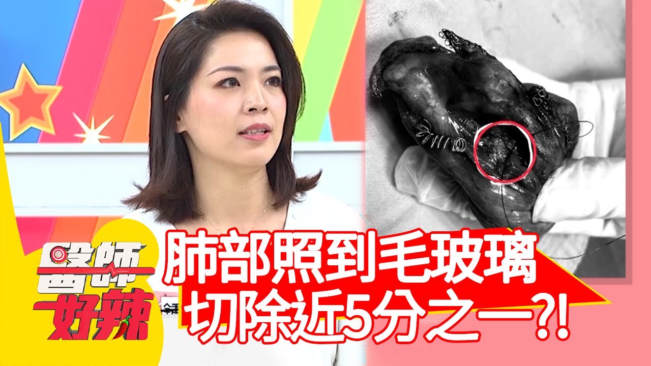 肺部照到毛玻璃，切除近5分之一？！【#醫師好辣】20210223 part2 EP1103 董至成 陳木榮