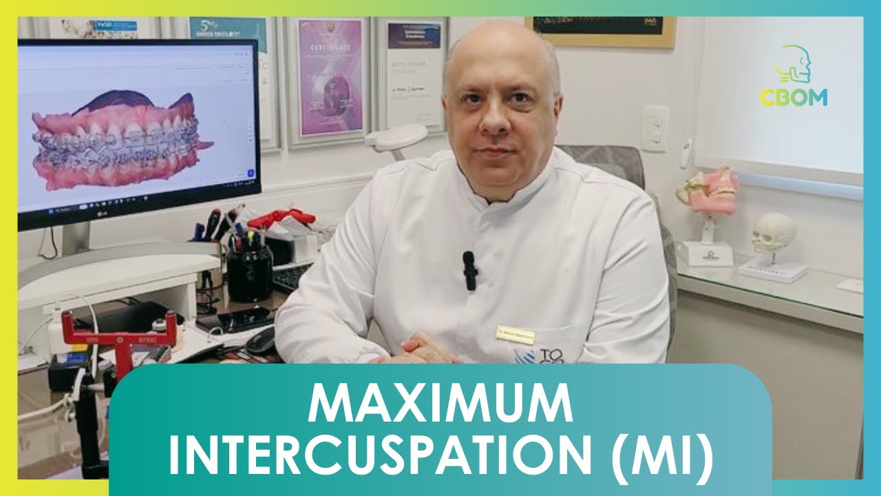 Maximum Intercuspation (MI)