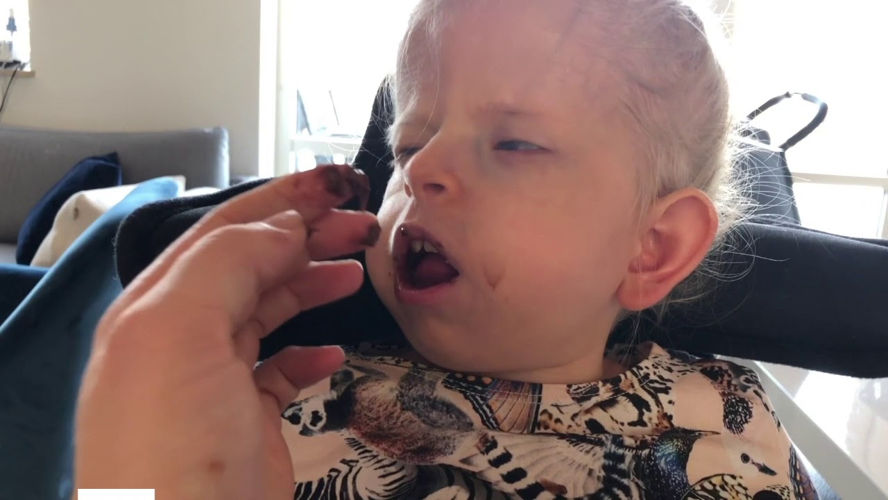 The Schinzel-Giedion Syndrome Foundation Rare Disease Day 2021 Video