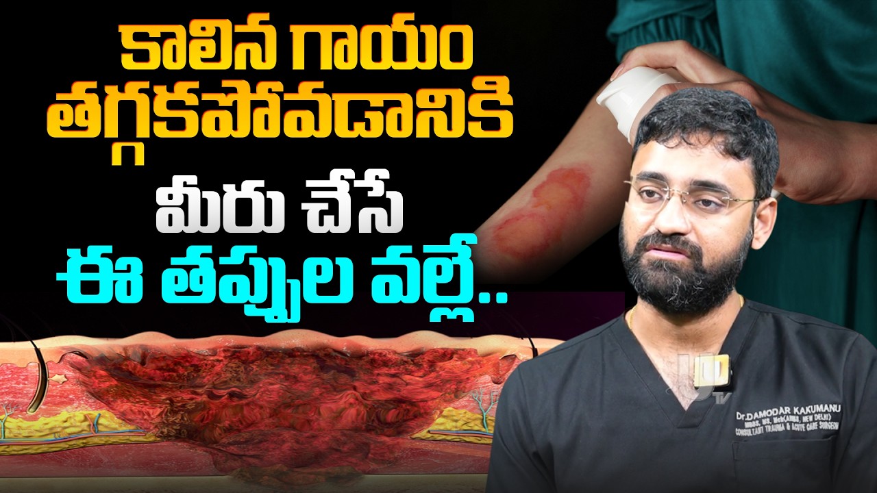 కాలిన గాయం తగ్గకపోవడానికి మీరు చేసే ఈ తప్పుల వల్లే.. | Burned Skin | Dr. Kakumanu Damodar