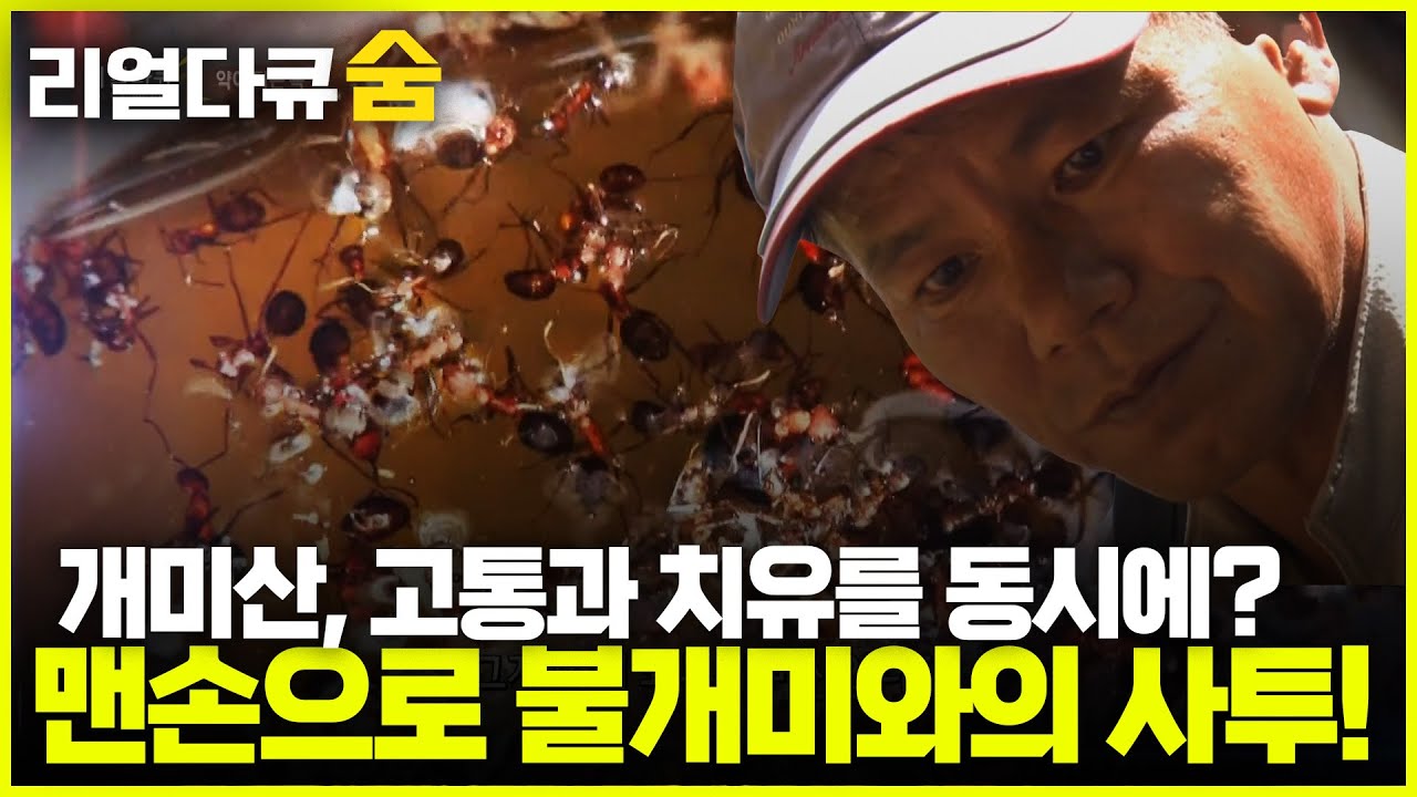 개미산, 고통과 치유를 동시에? 맨손으로 불개미와의 사투! | 리얼다큐숨