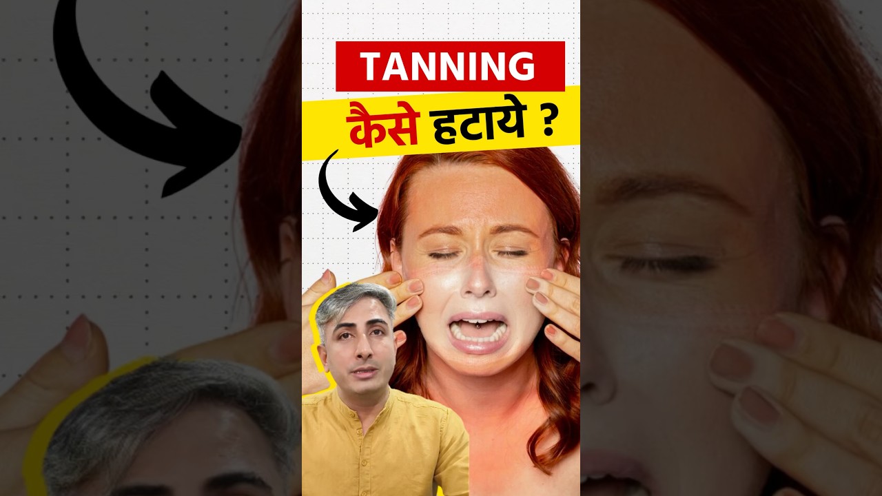 100% Working Sun Tan Removal Home Remedy | Remove Sun Tan at Home | Dr. Manoj Das