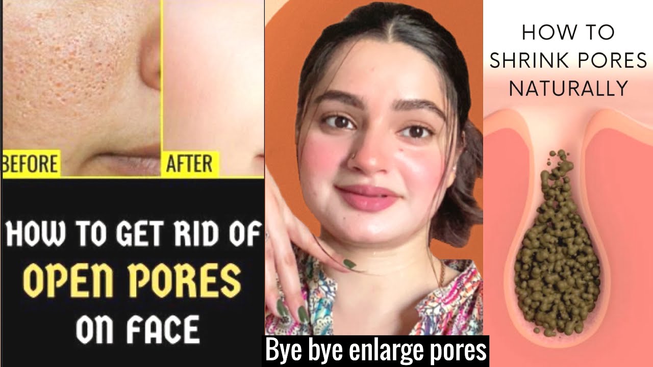 How to minimise OPEN PORES | HOW TO SHRINK OPENING PORES permanently 100%works