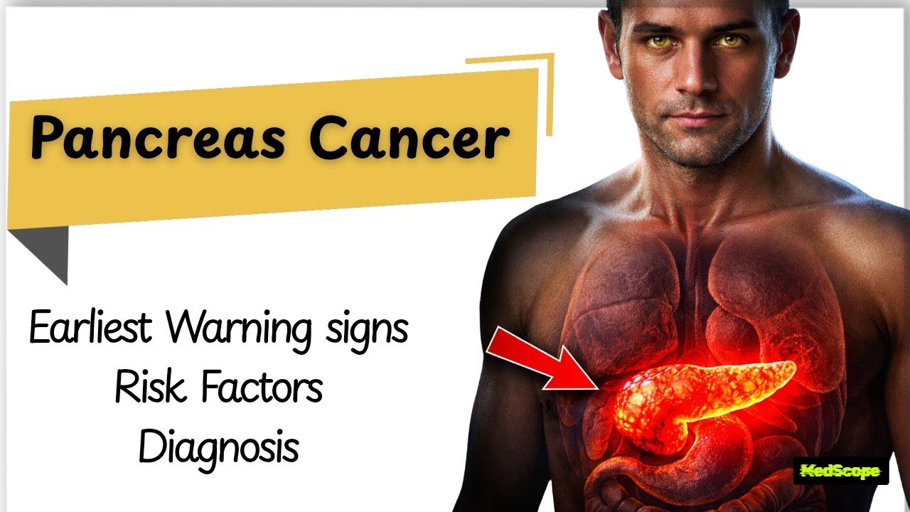 What are the WARNING Signs of Pancreatic Cancer?