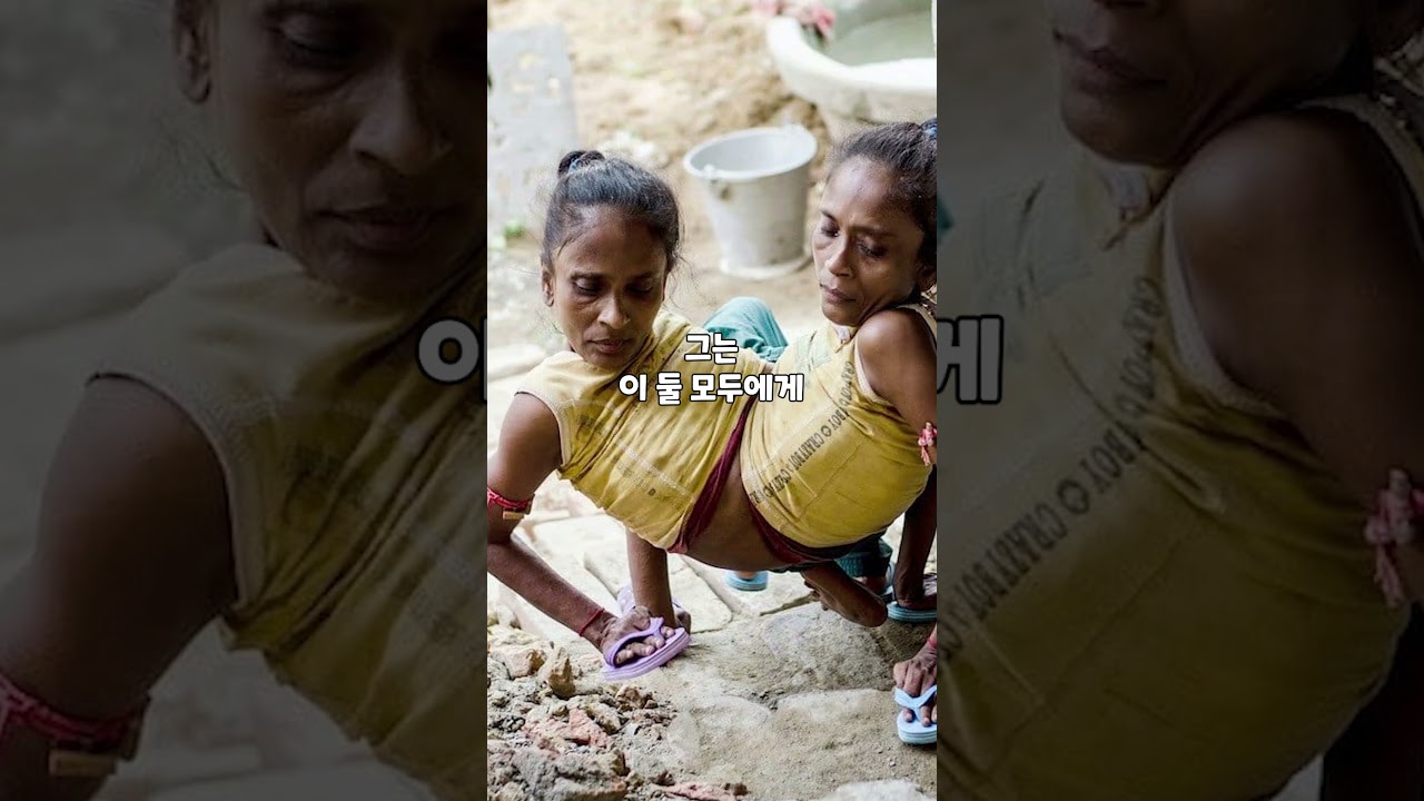 샴쌍둥이 자매와 사랑에 빠진 남자