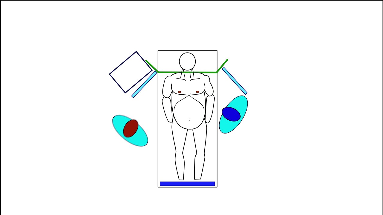 Geometry Fundoplication App Tutorial, Chapter 03: Operating Room SetUp and Placement of the Trocars