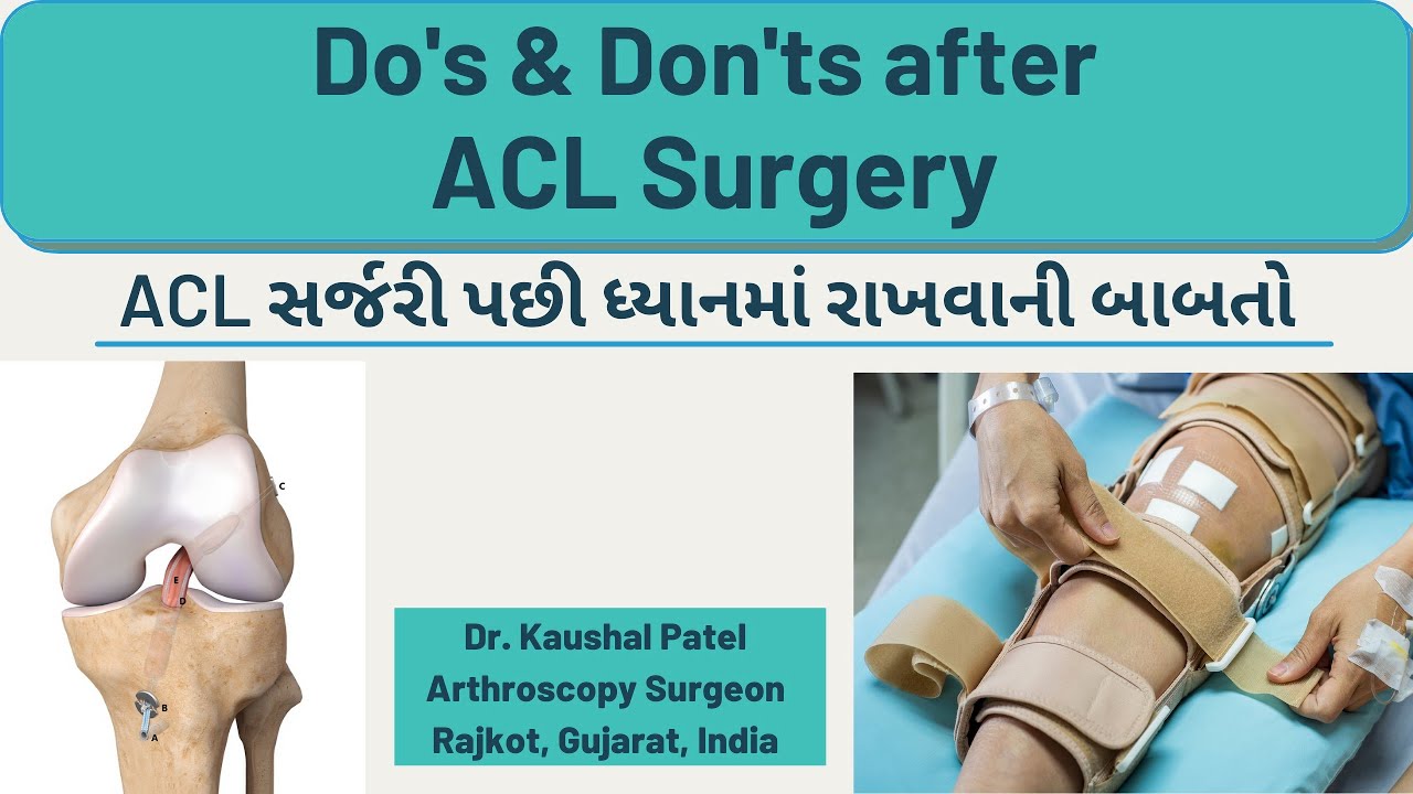 Do's and Don'ts after ACL surgery | ACL સર્જરી પછી ધ્યાનમા રાખવાની બાબતો #acl #aclrecovery