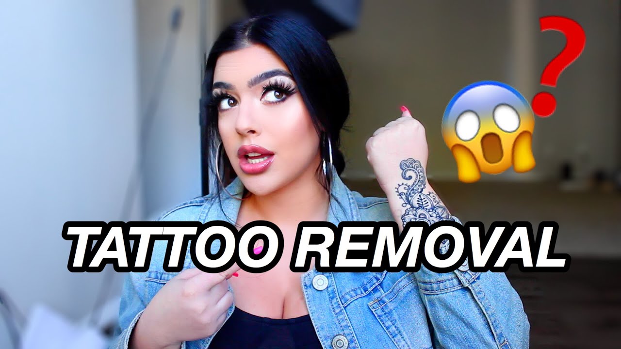 LASER TATTOO REMOVAL | My Experience, Cost, Pain | Marissa Paige
