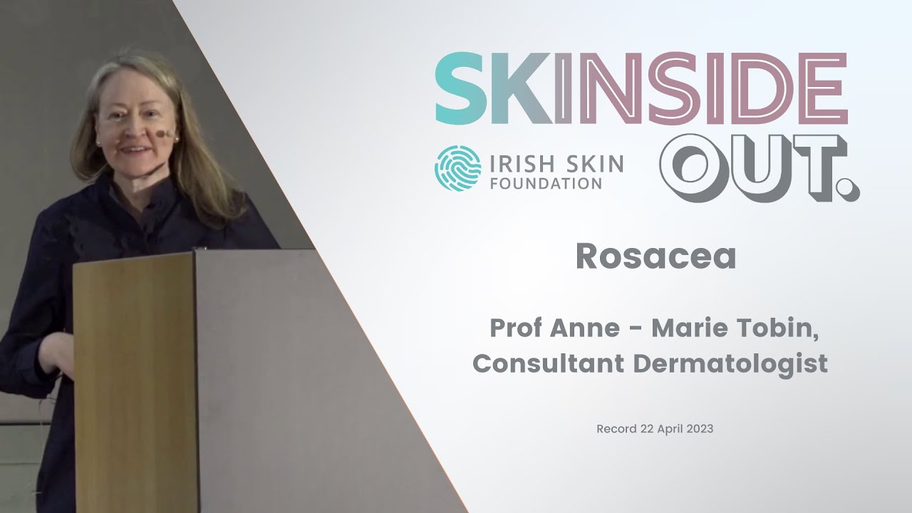 Rosacea: Presented by Prof Anne - Marie Tobin, Consultant Dermatologist