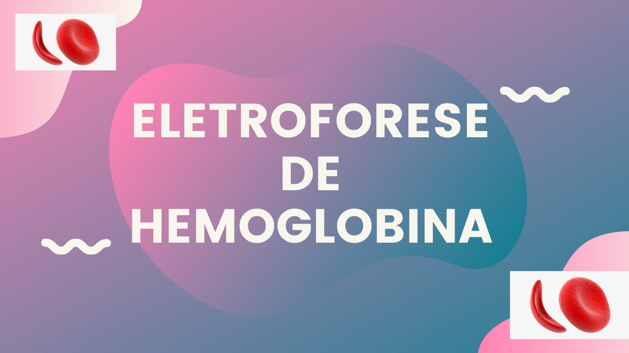 Eletroforese de Hemoglobina