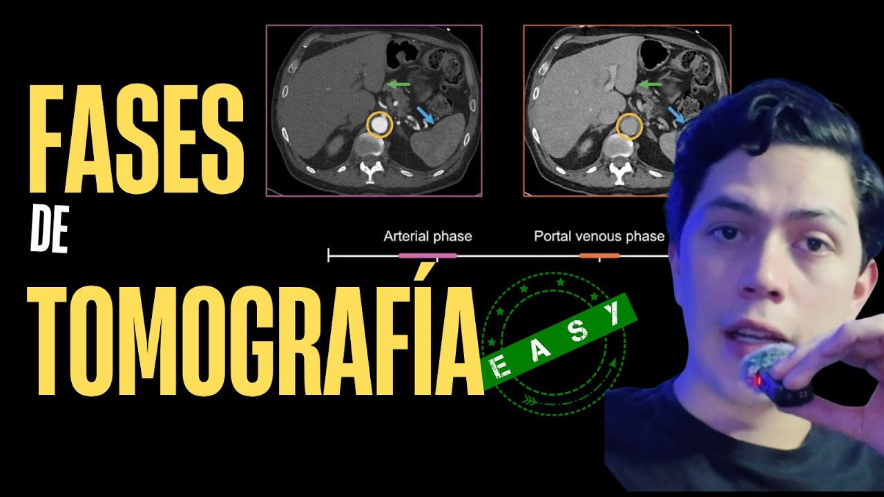 FASES DE TOMOGRAFÍA COMO NUNCA TE LAS HABÍAN EXPLICADO