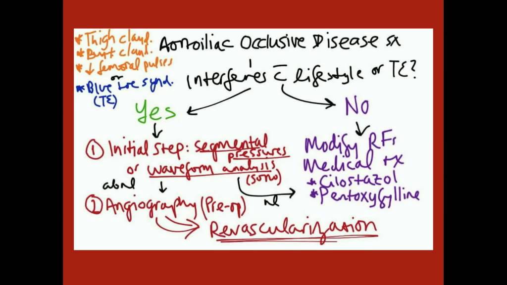 Aortoiliac Occlusive Disease - CRASH! Medical Review Series