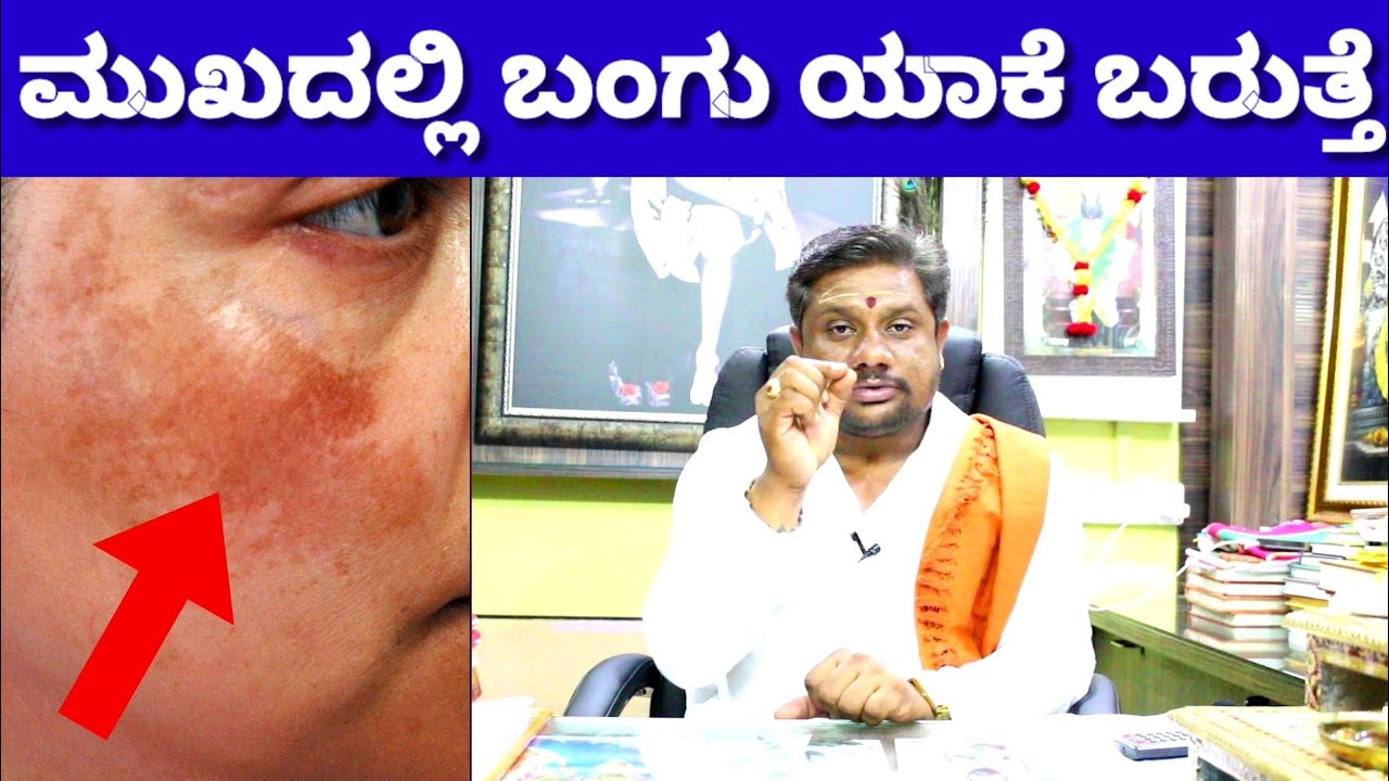 ಮುಖದ ಮೇಲೆ ಬಂಗು ಇರುವವರು ಈ ವಿಡಿಯೋ ನೋಡಿ | Pigmention in Face | Vasudevan | Newz Alert