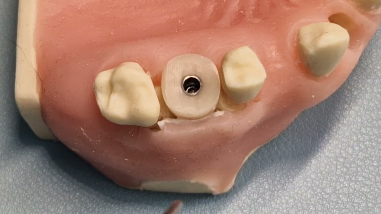 Powerbone Flexible