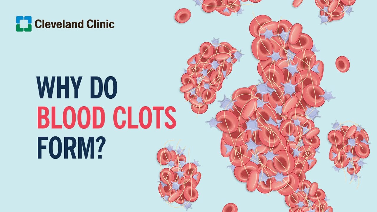 Why Do Blood Clots Form?