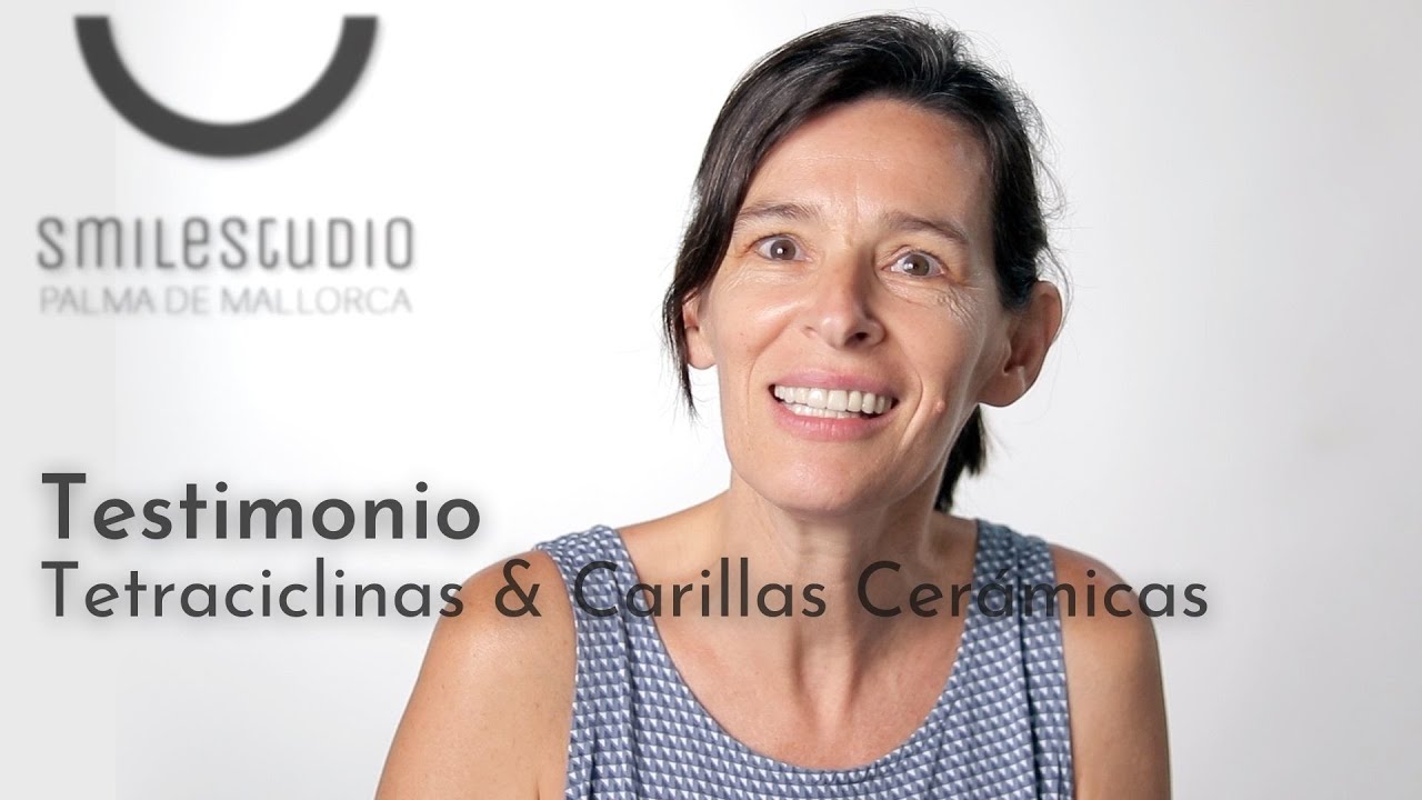 Testimonio Tetraciclinas & Carillas Cerámicas | Excellence Dental &  Smile Studio Mallorca