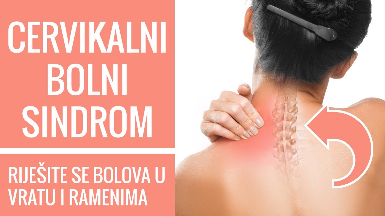 Cervikalni bolni sindrom (BOL U VRATU I BOLOVI U RAMENIMA) | Liječenje i savjeti fizijatra