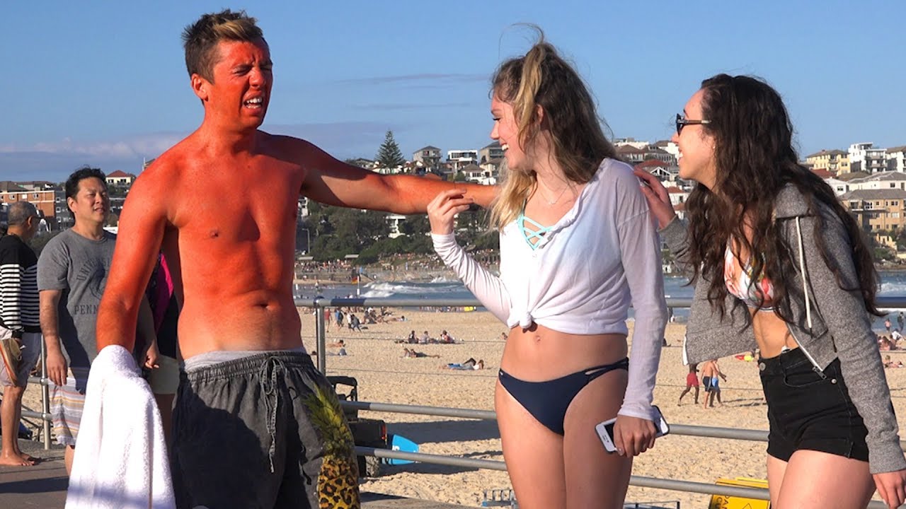 EXTREME SUNBURN PRANK!
