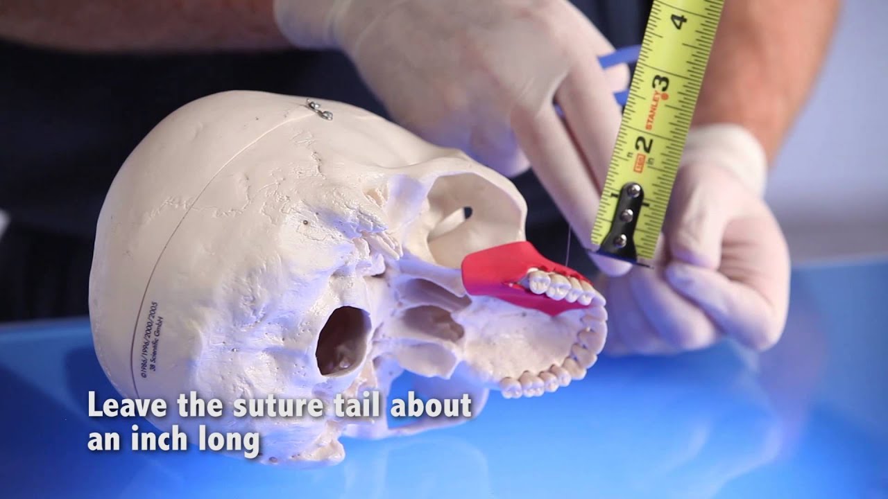 10 Tips for Dental Suturing  | Enamel Pearls