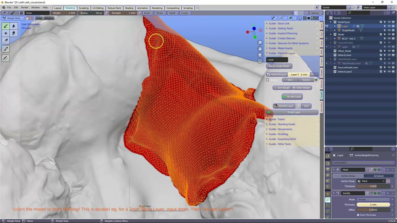 Making an Implant Membrane