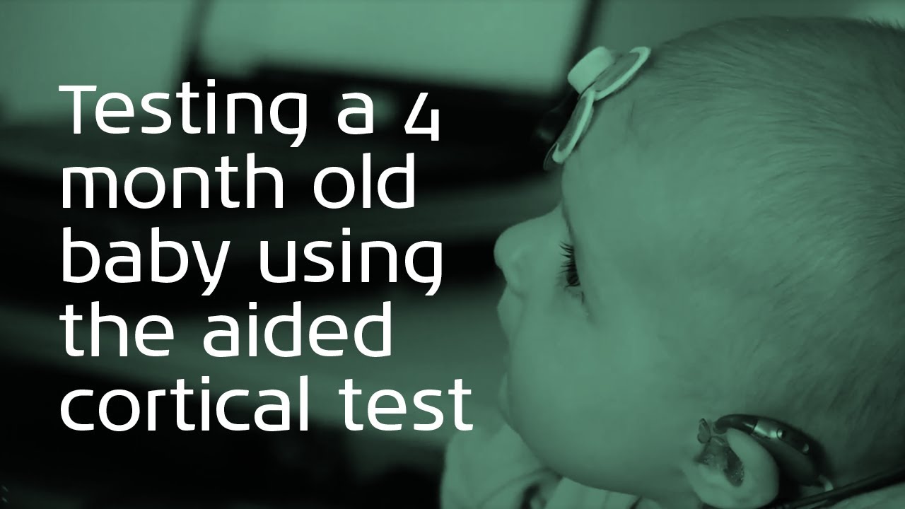Testing a 4 month old baby using the aided cortical test