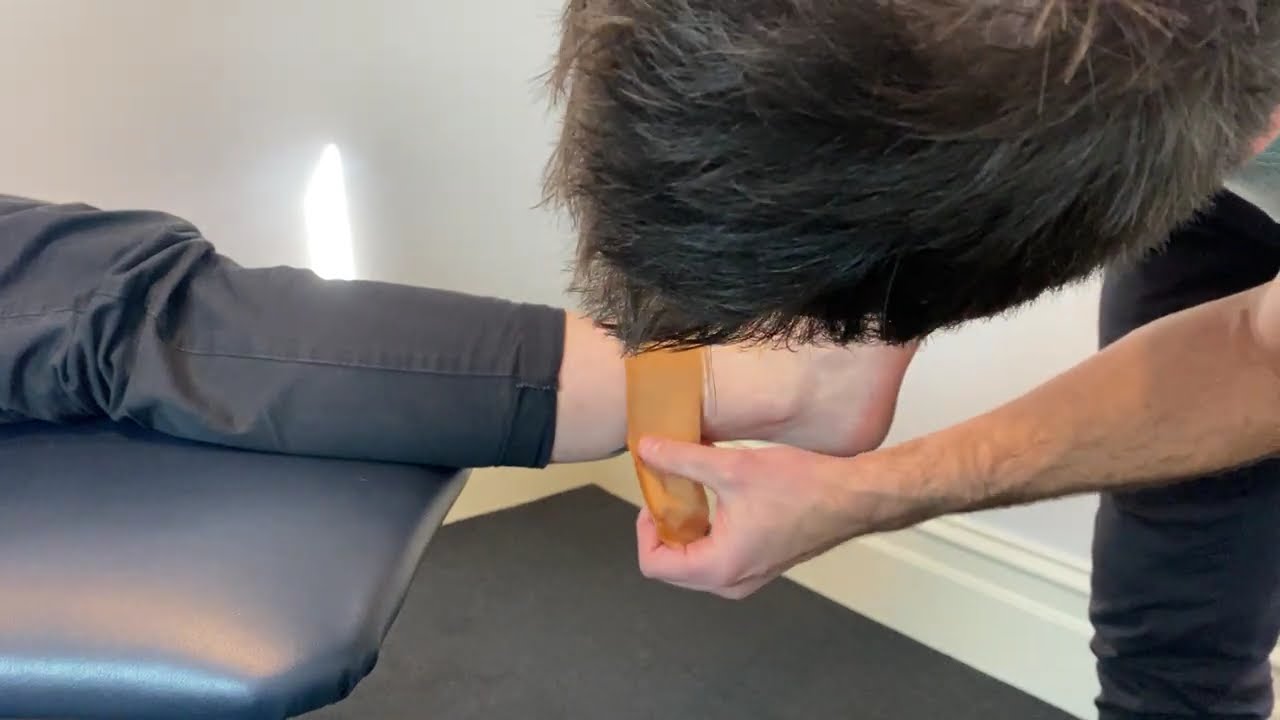 Syndesmosis Injury Taping