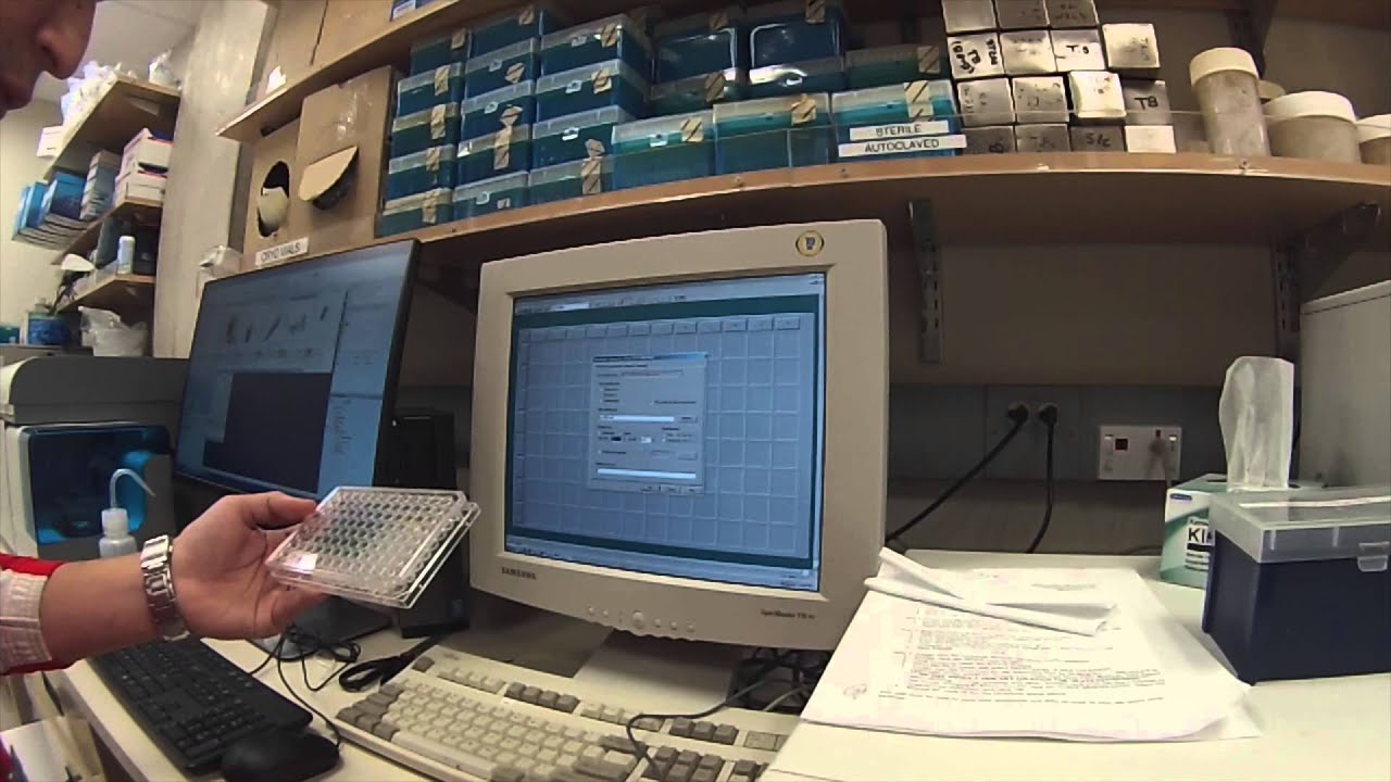 How to Read an ELISA Plate