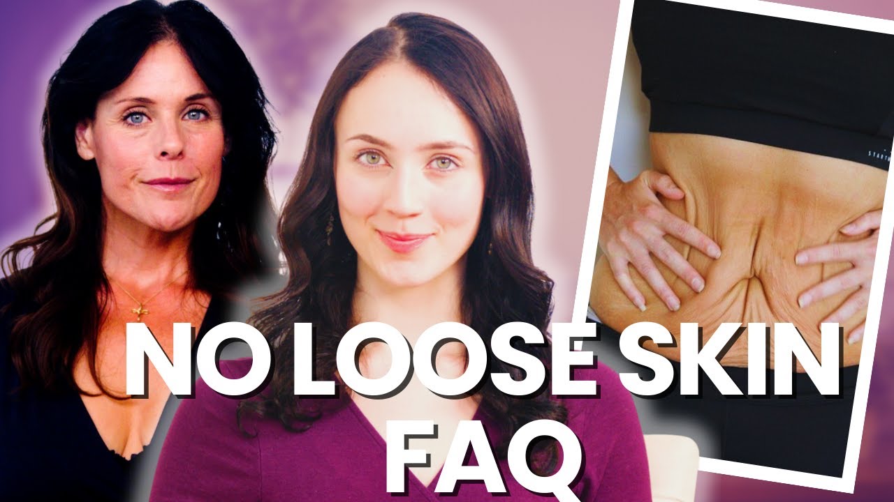 160 Pounds Lost Naturally | The Loose Skin Question Answered