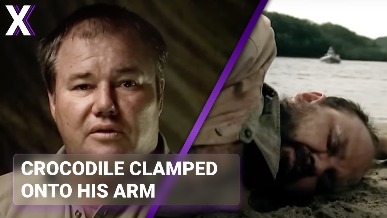 Crocodile Attack Survivor’s Harrowing Escape