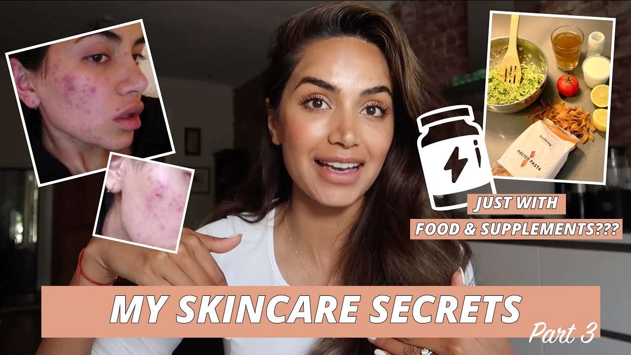 HOW I HEALED MY SKIN WITH FOOD AND SUPPLEMENTS // MY SKINCARE JOURNEY PART 3